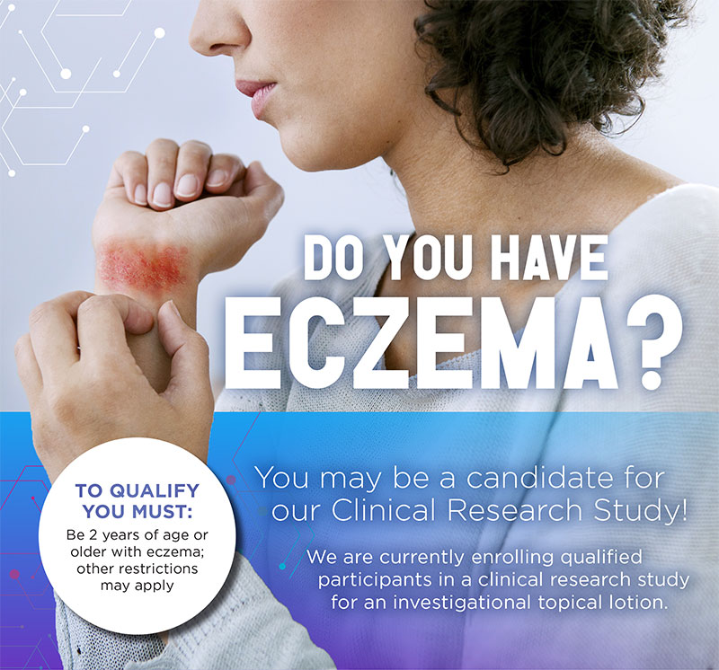 Do You Have Eczema?
